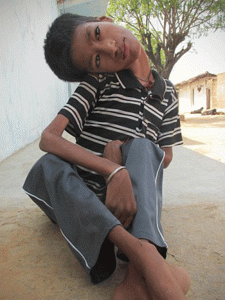 we d rather he were dead than suffer say parents whose son s head hangs at 180 degree angle