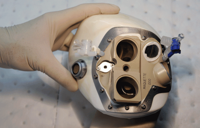 an employee of the french carmat company showing an artificial heart in the velizy suburb of paris photo afp an employee of the french carmat company showing an artificial heart in the velizy suburb of paris photo afp