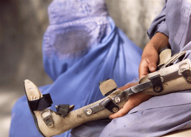 a young boy holds a brace belonging to his sister who was crippled by polio photo reuters a young boy holds a brace belonging to his sister who was crippled by polio photo reuters