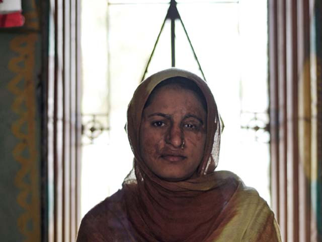 acid attack victim safiea 18 poses at her residence at khanwala village in multan photo afp acid attack victim safiea 18 poses at her residence at khanwala village in multan photo afp
