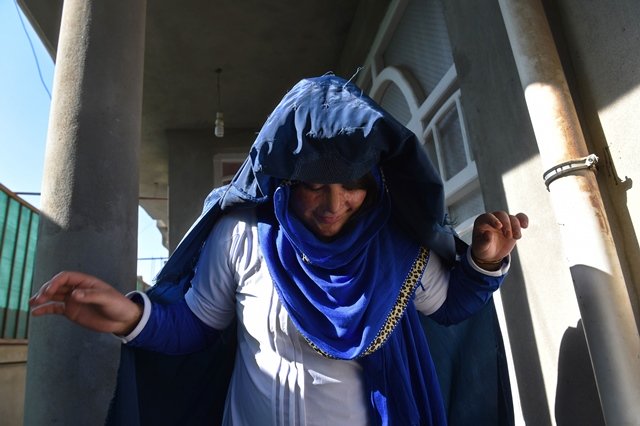 twenty year old afghan acid attack victim mumtaz walks outside a safe house in kunduz four years after a militiaman doused mumtaz with a flesh searing acid for rejecting his marriage proposal leaving her disfigured scarred and traumatised death threats have forced the 20 year old afghan into hiding photo afp