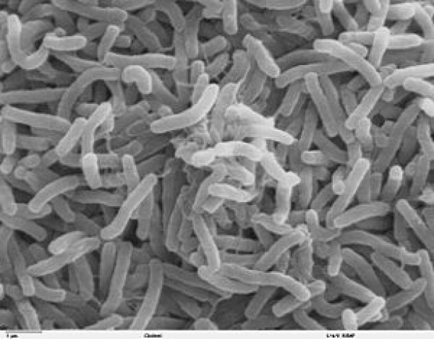 two killed in upper dir cholera outbreak two killed in upper dir cholera outbreak