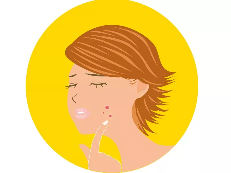 as the heat and humidity turn up so do pimples on your skin design maryam rashid as the heat and humidity turn up so do pimples on your skin design maryam rashid