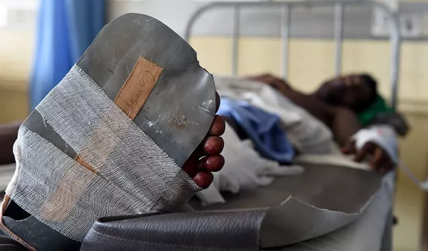 a sri lankan man wounded during a shooting at a ruling party election rally lies in the main hospital of colombo on july 31 2015 photo afp a sri lankan man wounded during a shooting at a ruling party election rally lies in the main hospital of colombo on july 31 2015 photo afp