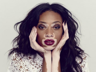 comfortable in her own skin she was teased before but now she is a star