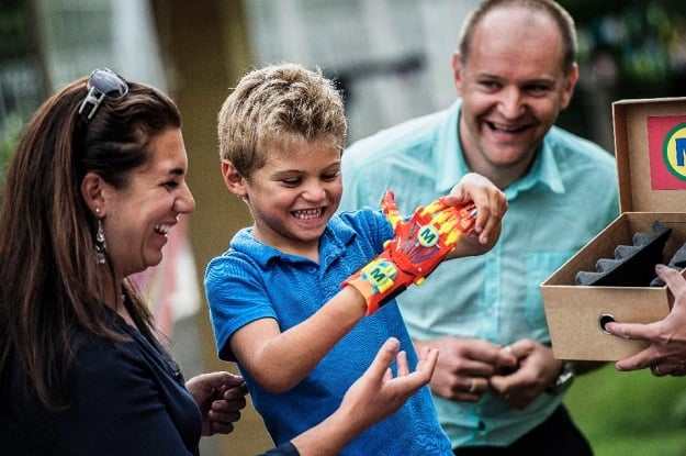 a boy born with a right hand malformation tries on his new 3d printed hand given to him by the association for the study and assistance of child amputees on august 17 2015 in cessieu photo afp