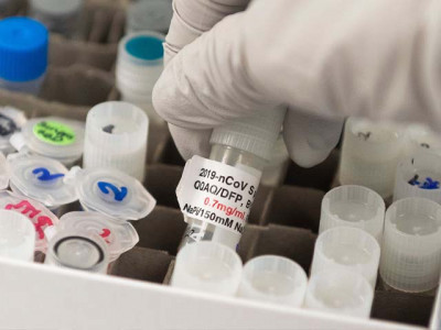 us china and the peculiar race for the coronavirus vaccine us china and the peculiar race for the coronavirus vaccine