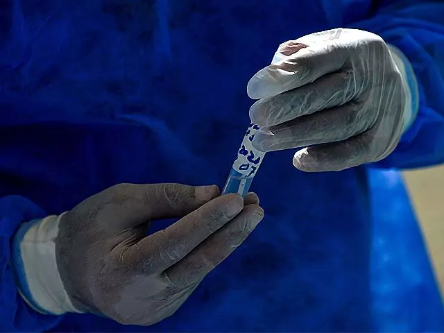 a medical staff member wearing protective gear holds a coronavirus sample in karachi photo getty a medical staff member wearing protective gear holds a coronavirus sample in karachi photo getty
