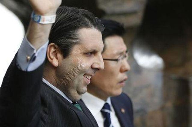 us ambassador to south korea mark lippert waves as he leaves a hospital in seoul march 10 2015 photo reuters us ambassador to south korea mark lippert waves as he leaves a hospital in seoul march 10 2015 photo reuters