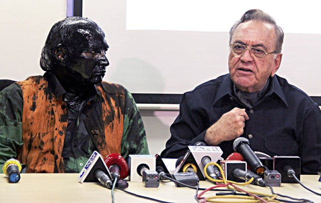 indian activist sudheendra kulkarni l whose face was blackened by ink in an alleged attack looks on as former pakistani foreign minister khurshid mahmud kasuri speaks to media in mumbai on october 12 2015 photo afp indian activist sudheendra kulkarni l whose face was blackened by ink in an alleged attack looks on as former pakistani foreign minister khurshid mahmud kasuri speaks to media in mumbai on october 12 2015 photo afp