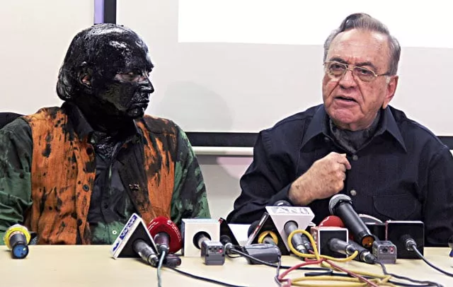 indian activist sudheendra kulkarni l whose face was blackened by ink in an alleged attack looks on as former pakistani foreign minister khurshid mahmud kasuri speaks to media in mumbai on october 12 2015 photo afp indian activist sudheendra kulkarni l whose face was blackened by ink in an alleged attack looks on as former pakistani foreign minister khurshid mahmud kasuri speaks to media in mumbai on october 12 2015 photo afp