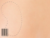 illegal business police uncover kidney smuggling ring