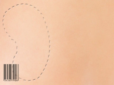 illegal business police uncover kidney smuggling ring