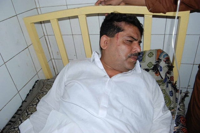 an injured sepco official photo express an injured sepco official photo express