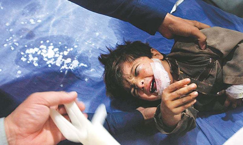 an injured boy being treated in a hospital in peshawar photo ap