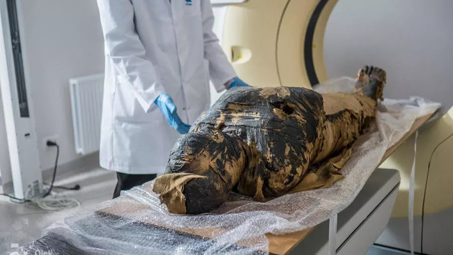 x ray images showed a little foot in the belly of the world s first pregnant egyptian mummy aleksander leydo warsaw mummy project photo afp