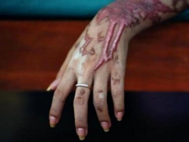 report finds women between 17 and 30 years of age to be most at risk photo reuters report finds women between 17 and 30 years of age to be most at risk photo reuters