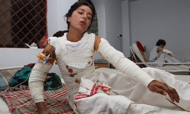 sonia bibi in hospital in multan on 23 october doctors initially believed she would recover but infection set in and she died on tuesday photo afp sonia bibi in hospital in multan on 23 october doctors initially believed she would recover but infection set in and she died on tuesday photo afp