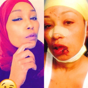 woman s face smashed with beer mug at us restaurant for not speaking english woman s face smashed with beer mug at us restaurant for not speaking english