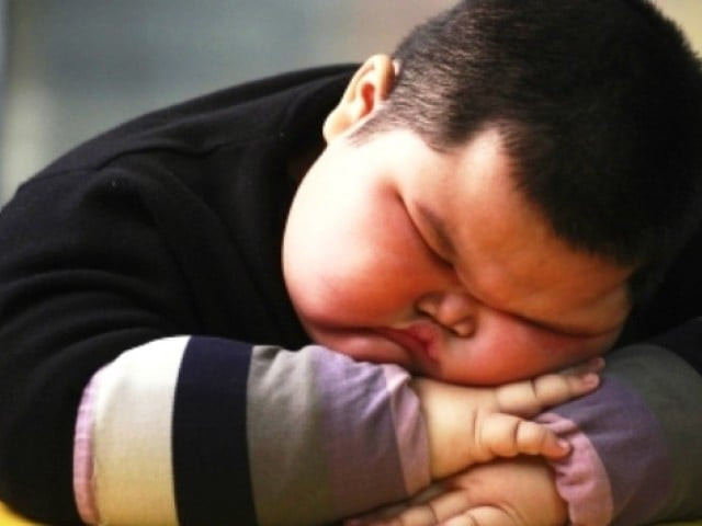 researchers compared 20 obese children and teenagers to 20 normal weight peers and found 40 percent were at high risk photo reuters file