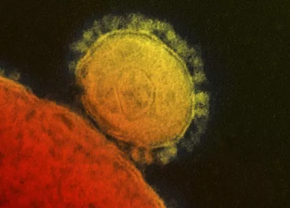 official nih says pakistan lacks an integrated surveillance system that can help tackle all diseases well in time photo reuters official nih says pakistan lacks an integrated surveillance system that can help tackle all diseases well in time photo reuters