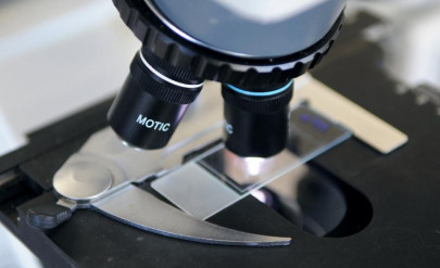 lab grown vocal cord tissue may offer transplant solution