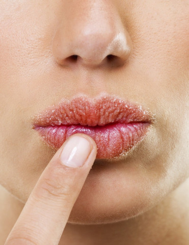sick of the hassle and pain of parched lips follow these tips to make them soft and smooth photo reflectionsatlukes com sick of the hassle and pain of parched lips follow these tips to make them soft and smooth photo reflectionsatlukes com