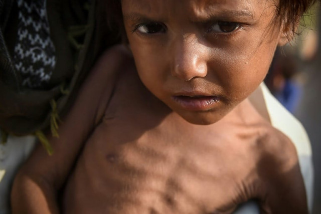 pakistan is facing a second wave of catastrophe following devastating floods photo afp pakistan is facing a second wave of catastrophe following devastating floods photo afp