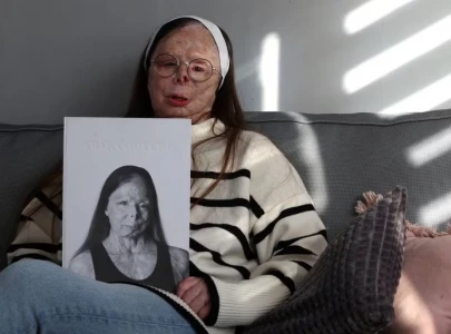 acid attack survivor fronts fashion book in new awareness campaign acid attack survivor fronts fashion book in new awareness campaign