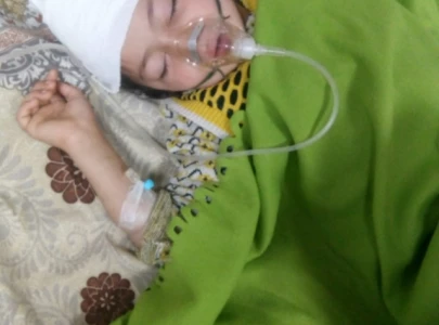 another minor falls prey to aerial firing suffers head injury in peshawar