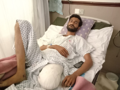 young man loses leg after being shot by police over polio vaccine dispute young man loses leg after being shot by police over polio vaccine dispute