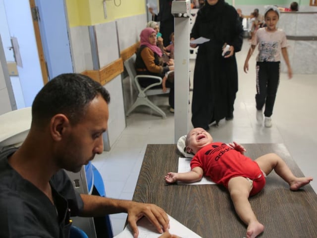 a palestinian child is examined by a doctor at nasser hospital as united nations officials are preparing to launch a polio vaccination campaign on sunday that will rely on a series of limited pauses in fighting between israeli forces and hamas in khan younis in the southern gaza strip photo reuter