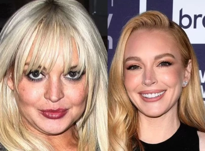 lindsay lohan s 300k plastic surgery transformation expert breaks down her new look