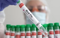 pakistan poorly equipped for hpai crisis experts warn pakistan poorly equipped for hpai crisis experts warn