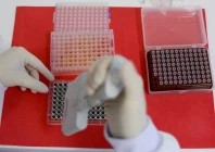 an employee dilutes poultry serum samples for elisa test for the detection of antibodies to the avian influenza virus at the reference laboratory of the world organization for animal health in campinas brazil april 25 2023 photo reuters an employee dilutes poultry serum samples for elisa test for the detection of antibodies to the avian influenza virus at the reference laboratory of the world organization for animal health in campinas brazil april 25 2023 photo reuters