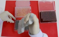 flu test gaps pose risk of outbreak flu test gaps pose risk of outbreak