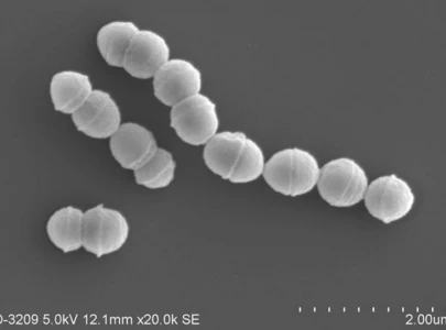 new evidence of historical japanese germ warfare unit unveiled across china new evidence of historical japanese germ warfare unit unveiled across china