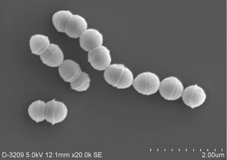 rare tissue damaging bacterial disease spreads in japan rare tissue damaging bacterial disease spreads in japan