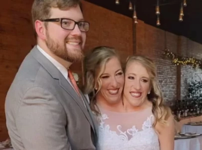 conjoined twins abby and brittany share throwback wedding pics with taylor swift song