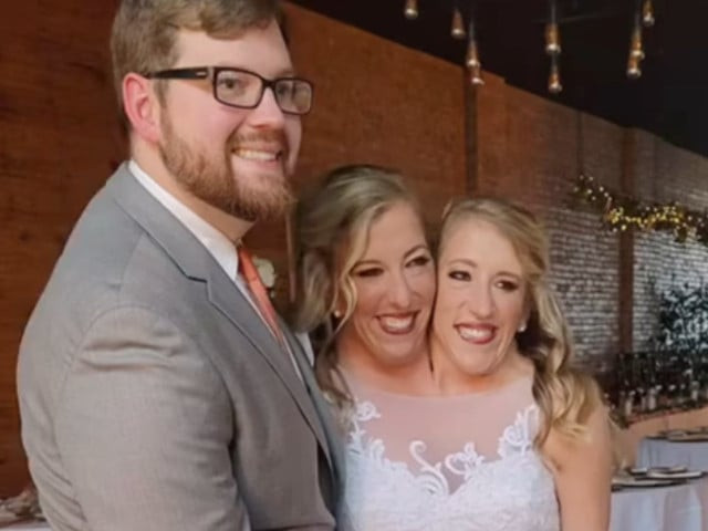 conjoined twins abby and brittany share throwback wedding pics with taylor swift song conjoined twins abby and brittany share throwback wedding pics with taylor swift song