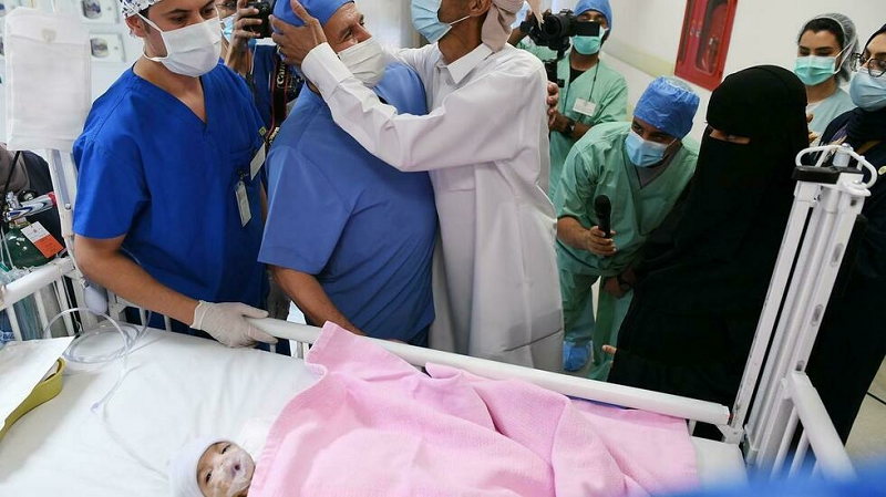 the father of a yemeni baby thanks doctors after successful surgery in saudi arabia to separate her from her parasitic twin   king salman humanitarian aid and relief centre photo afp