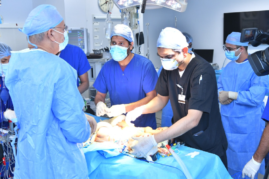 Conjoined twins healthy after separation surgery at AKUH - Vimarsana News