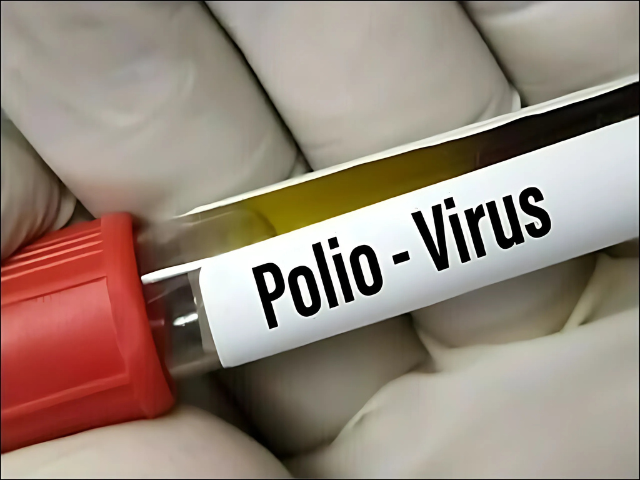 latest case in di khan brings k p polio tally to five latest case in di khan brings k p polio tally to five