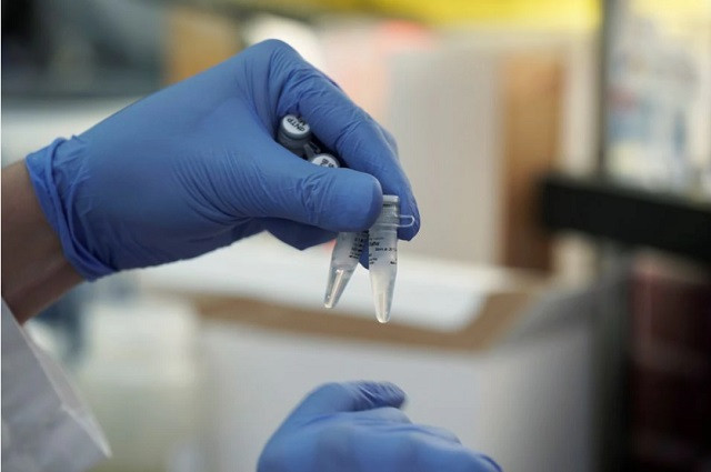 a scientist holds up sample vials inside a laboratory at sorrento therapeutics where efforts are underway to develop an antibody sti 1499 to help in prevention of the coronavirus disease covid 19 in san diego california us may 22 2020 photo reuters