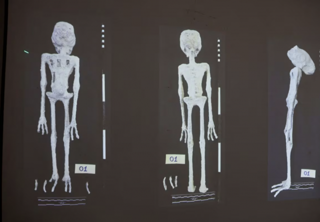 photo an x rays and study carried out by the institute of legal medicine of peru on the alien mummies that concluded that they are dolls made with animal bones is displayed in lima peru reuters