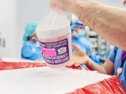 first patient to get gene edited pig kidney transplant dies hospital first patient to get gene edited pig kidney transplant dies hospital