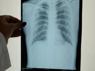 balochistan to get 30 ai equipped x ray machines