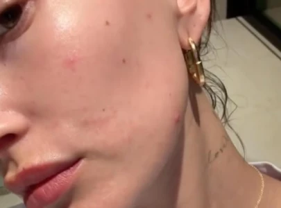 hailey bieber opens up about her skin disorder revealing a pretty bad flare up hailey bieber opens up about her skin disorder revealing a pretty bad flare up