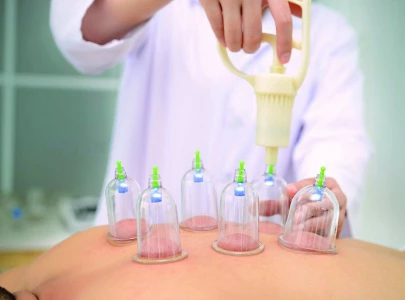 expert undrapes intricacies of hijama expert undrapes intricacies of hijama