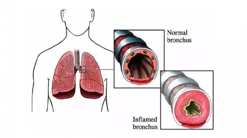 gulshan e maymar may be best neighbourhood for asthmatics gulshan e maymar may be best neighbourhood for asthmatics